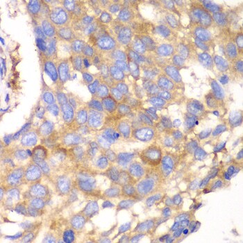 Calpain S1 Antibody
