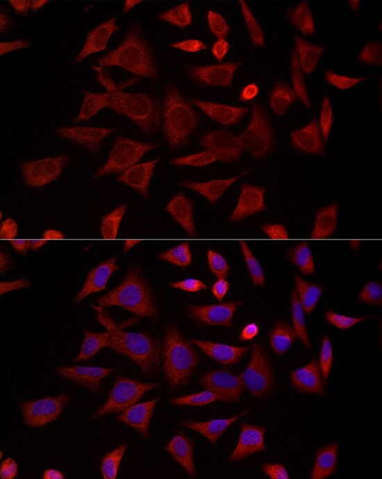 TCP1-delta Antibody