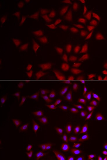 CIRBP Antibody