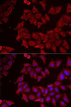 CMP kinase Antibody