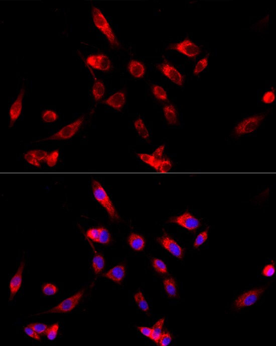 CYP4V2 Antibody