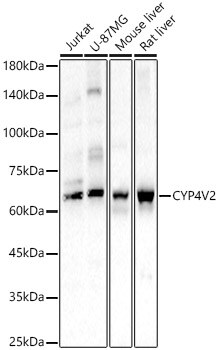 CYP4V2 Antibody