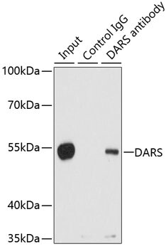 DARS Antibody