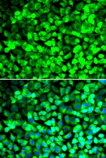 EIF5 Antibody