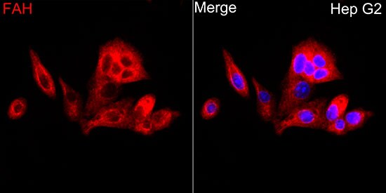 Fumarylacetoacetate hydrolase Antibody