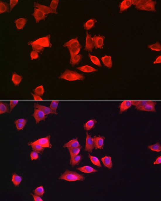 GAMT Antibody