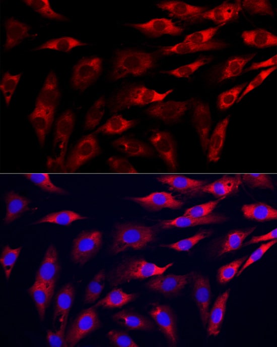 GAMT Antibody