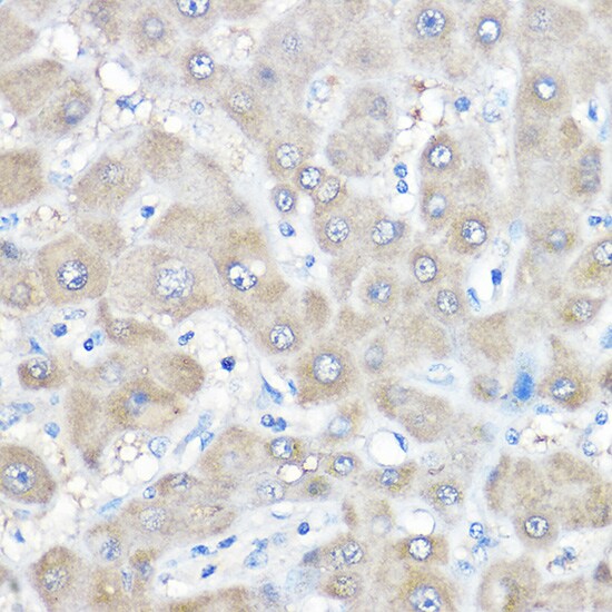 GAMT Antibody