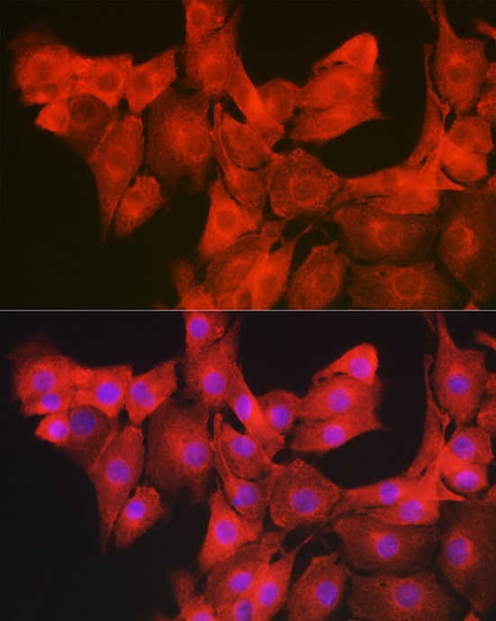 GAMT Antibody