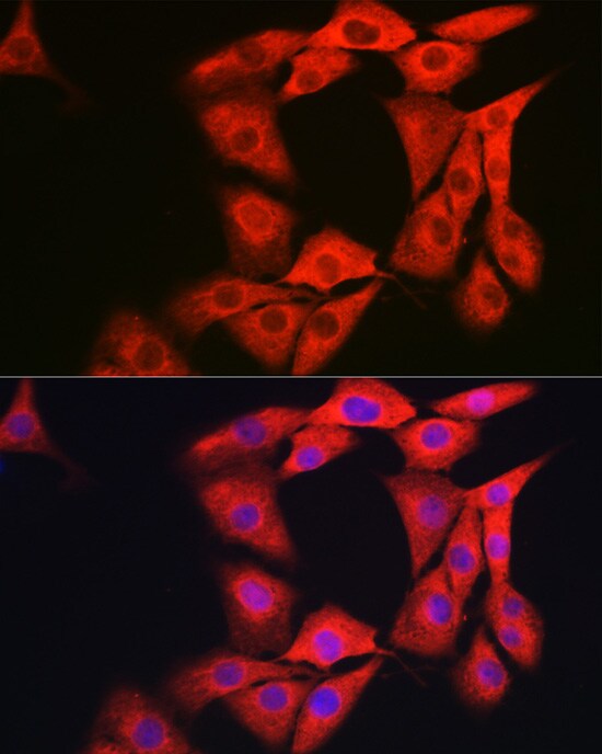 GAMT Antibody