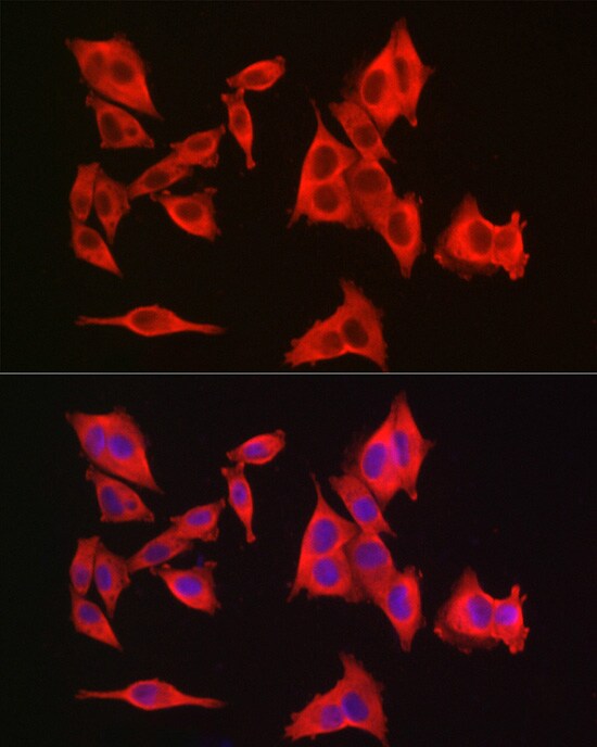 GAMT Antibody