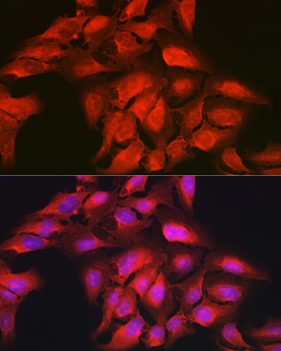 GAMT Antibody