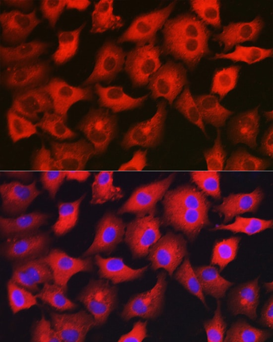 GAMT Antibody