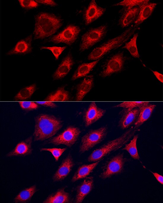 GAMT Antibody