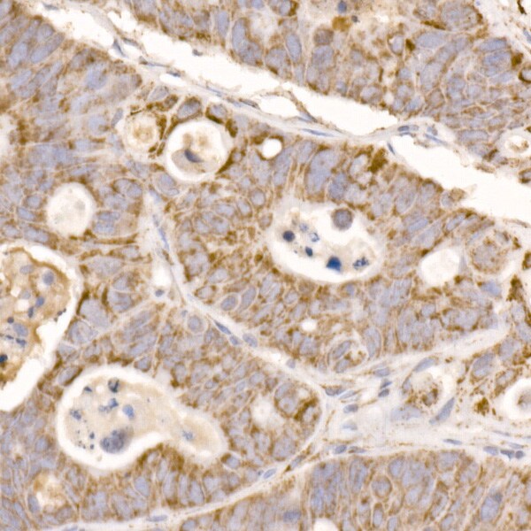 Glutamate Dehydrogenase 2/GLUD2 Antibody