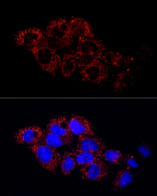 Glutamate Dehydrogenase 2/GLUD2 Antibody