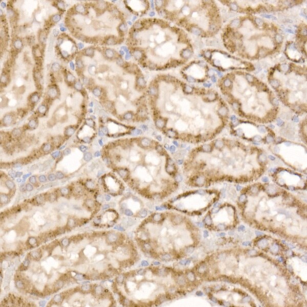 Glutamate Dehydrogenase 2/GLUD2 Antibody