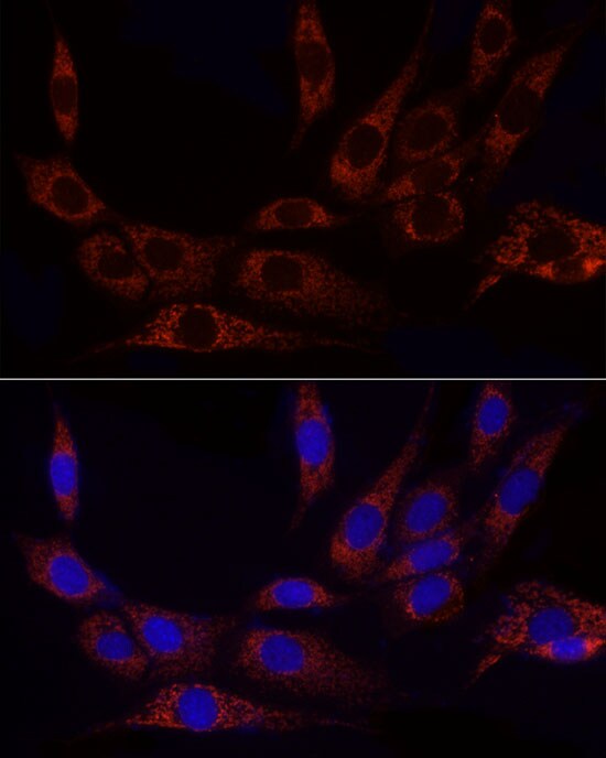 Glutamate Dehydrogenase 2/GLUD2 Antibody