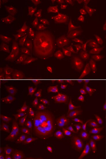 GRASP65 Antibody