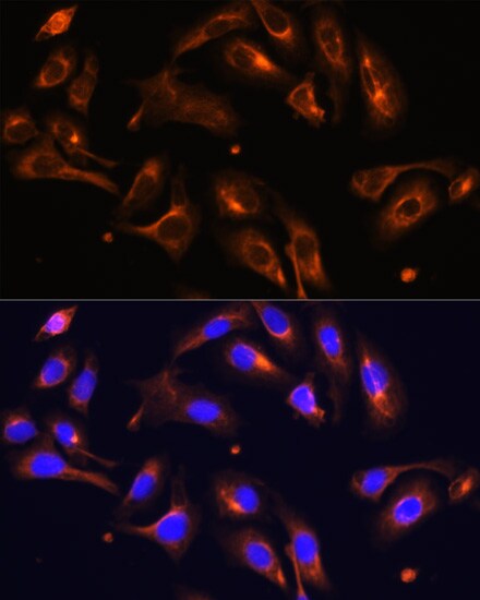 Melanophilin Antibody