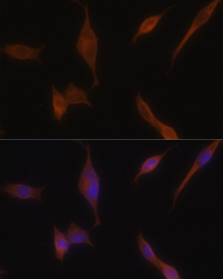 Melanophilin Antibody