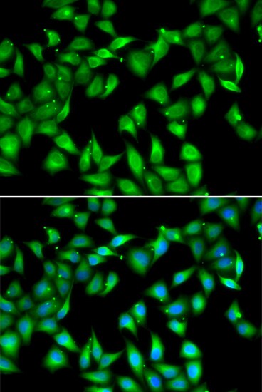 Myosin light chain 3 Antibody