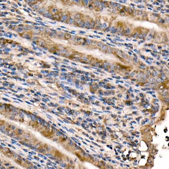 NFkB p105/p50 Antibody