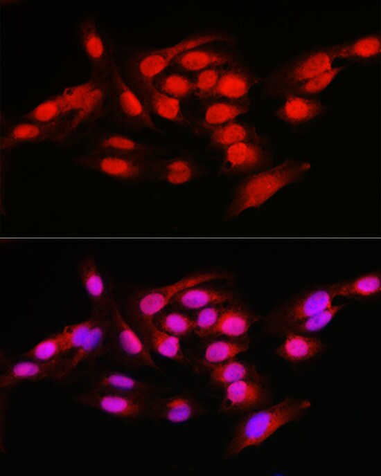 NFkB p105/p50 Antibody