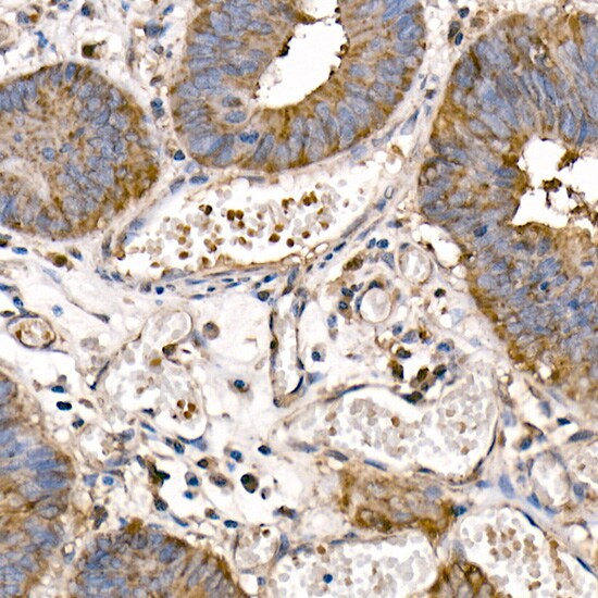NFkB p105/p50 Antibody