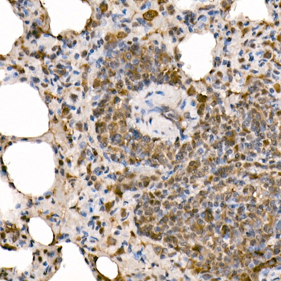 NFkB p105/p50 Antibody