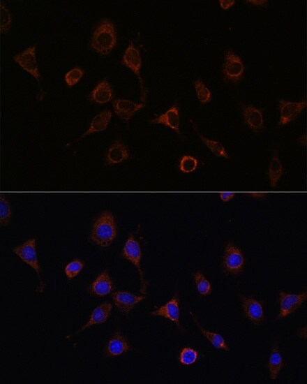 NFS1 Antibody