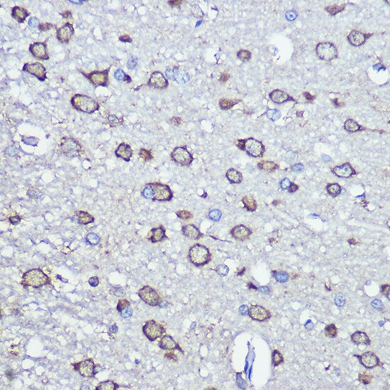 NFS1 Antibody