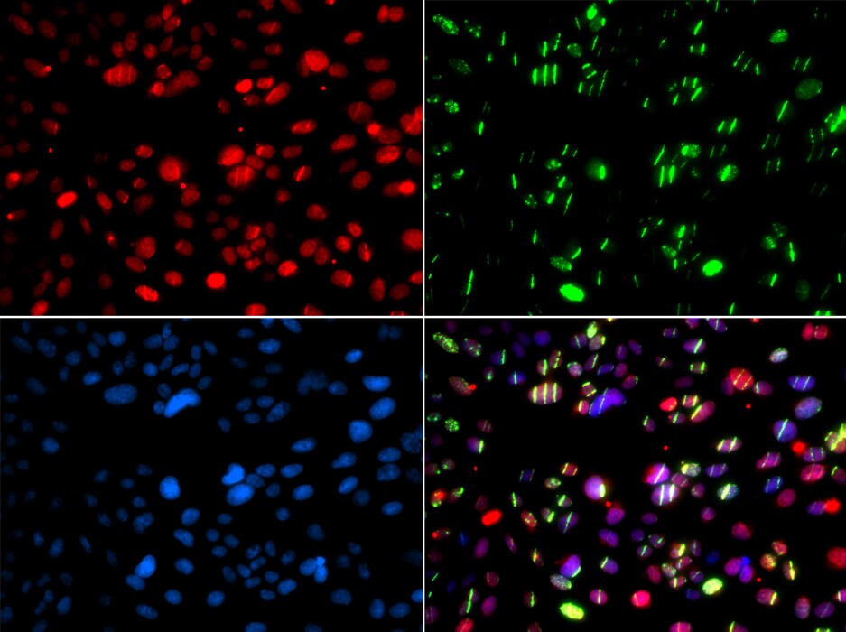 PNK Antibody