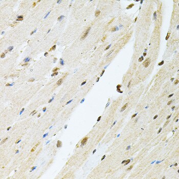 PNK Antibody