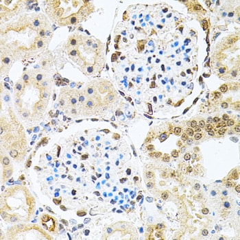 PNK Antibody