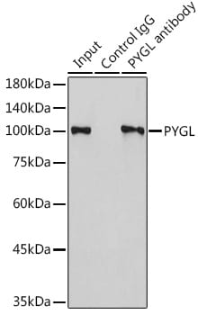 PYGL Antibody