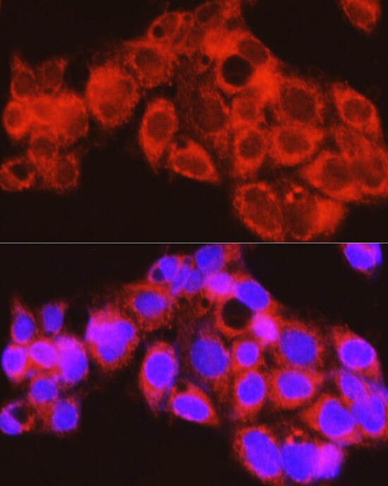PYGL Antibody