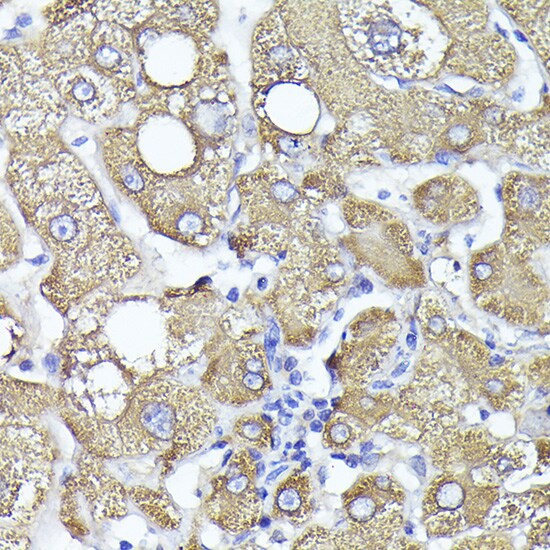 PYGL Antibody