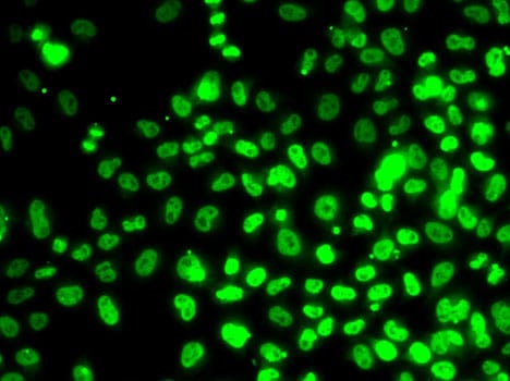 RPA14 Antibody