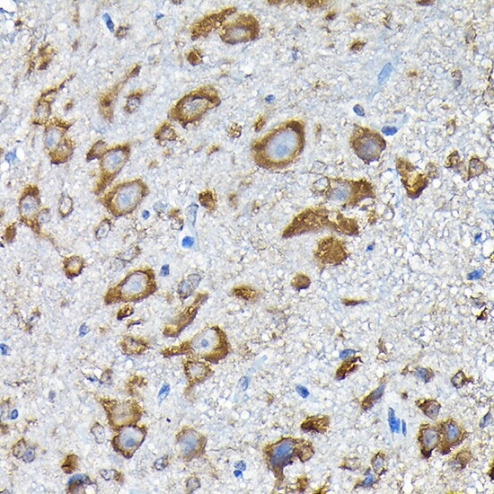 RPS14 Antibody