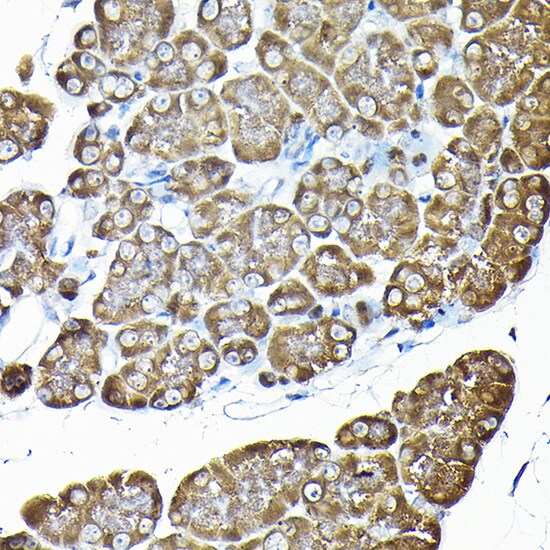 RPS14 Antibody