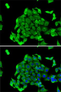 RPS14 Antibody