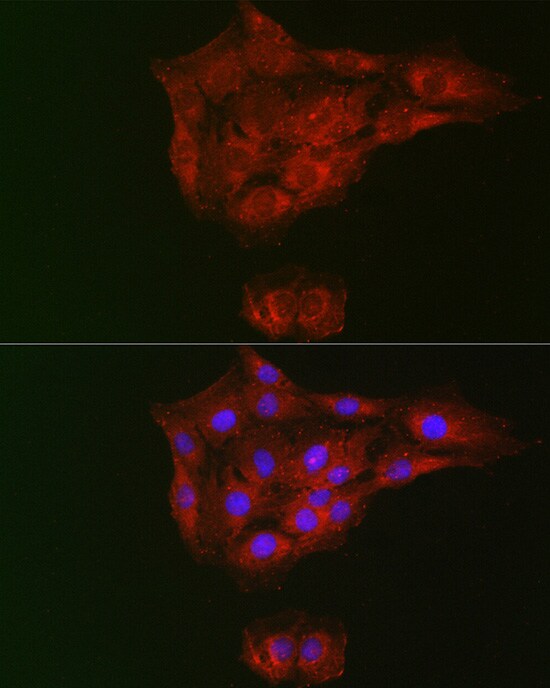 RTKN Antibody