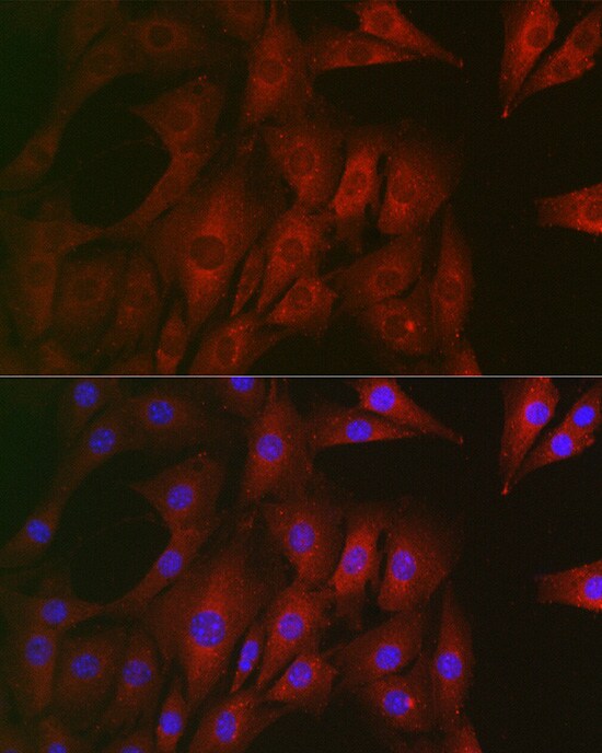 RTKN Antibody