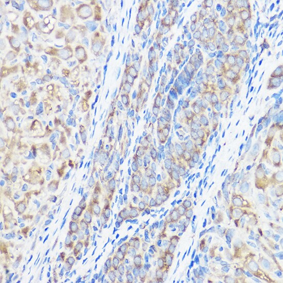 Seryl tRNA synthetase Antibody