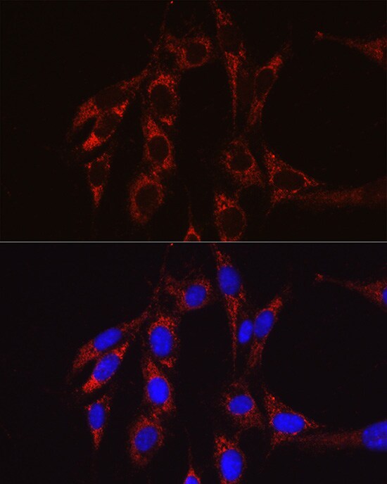 SECISBP2 Antibody