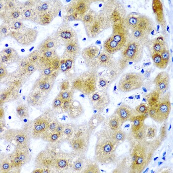 SECISBP2 Antibody