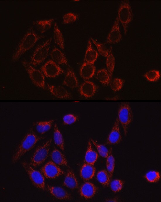 SECISBP2 Antibody