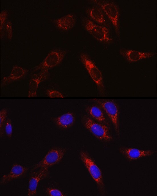 SECISBP2 Antibody