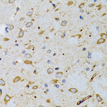 SRP19 Antibody